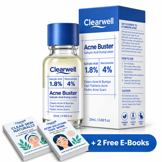 Clearwell Acne Lotion